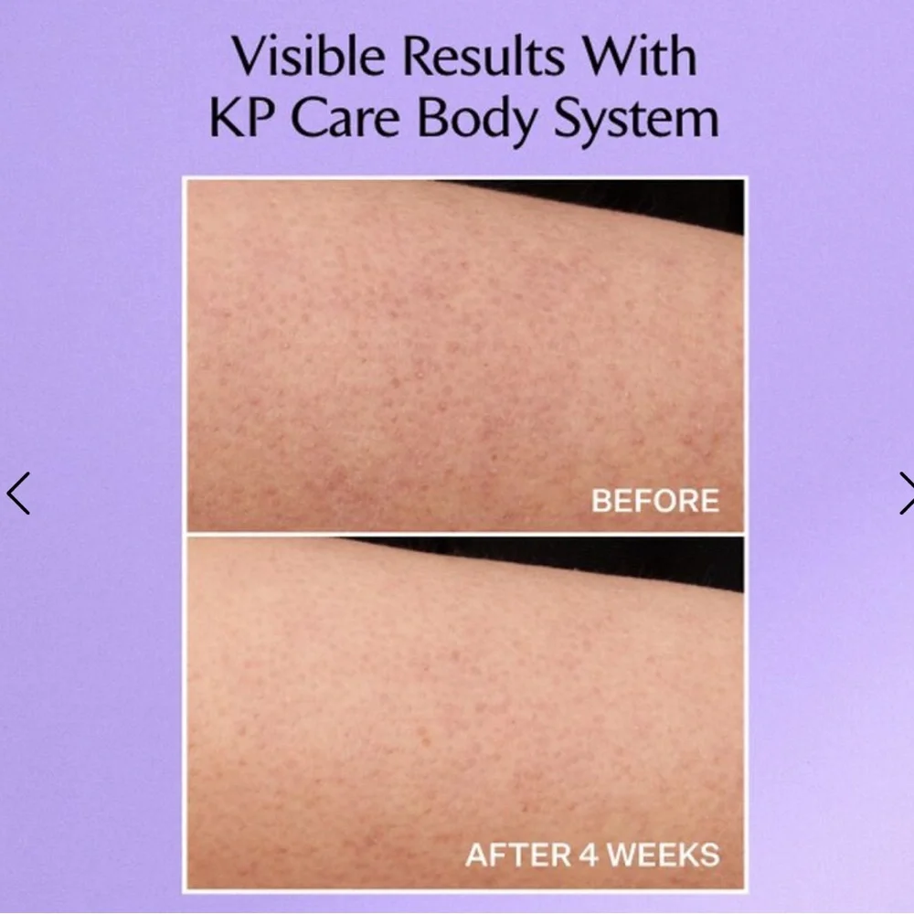 STRIVECTIN KP Care Bump Exfoliating Body Scrub 5oz NIB $30